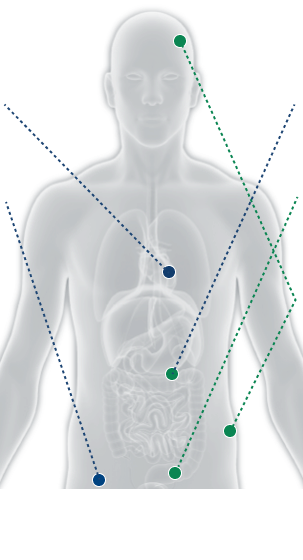 Graphical presentation of human body